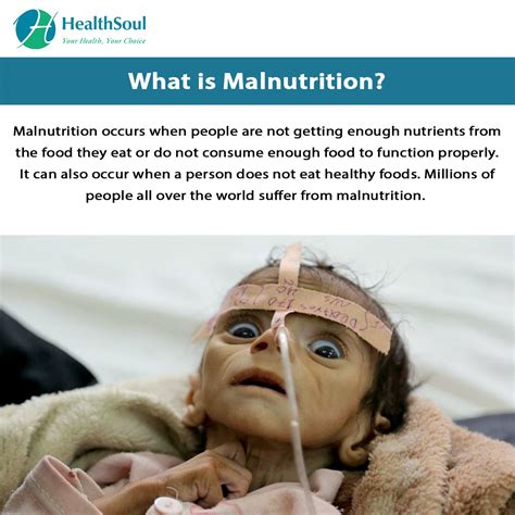 Malnutrition: Definition, Causes, Symptoms & Treatment.